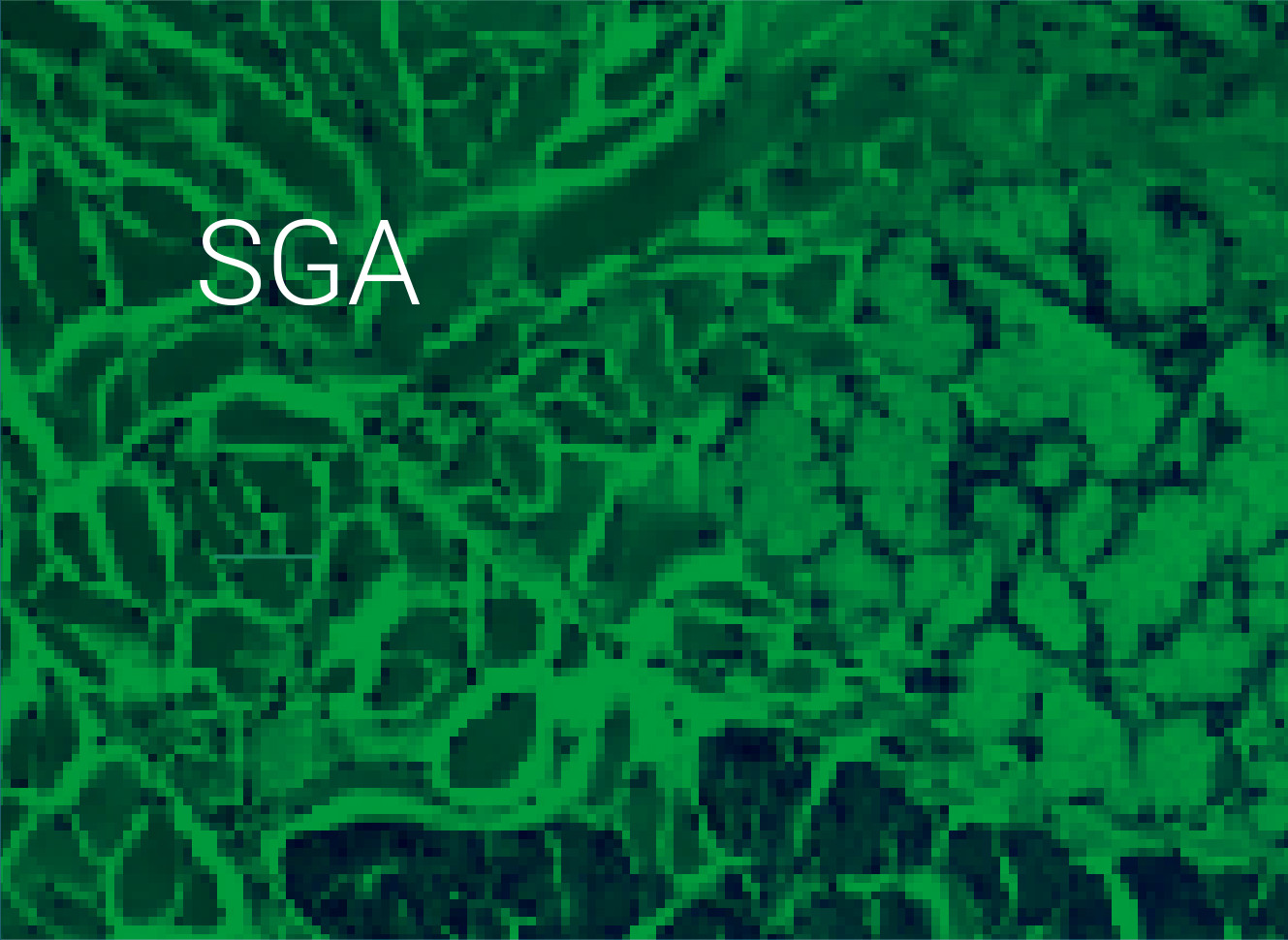 SGA